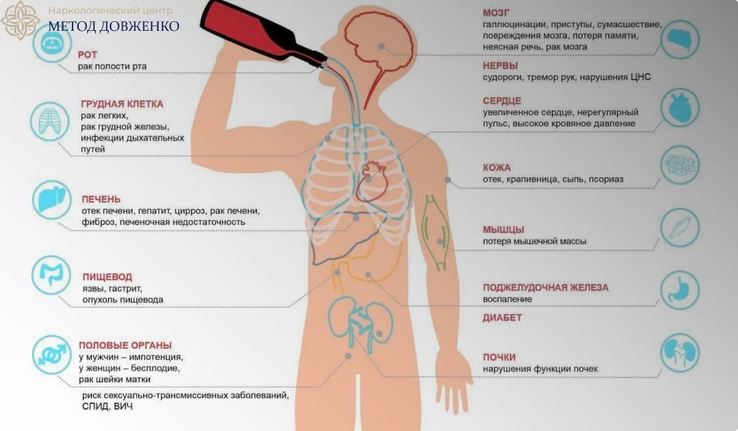 схема вреда алкоголя