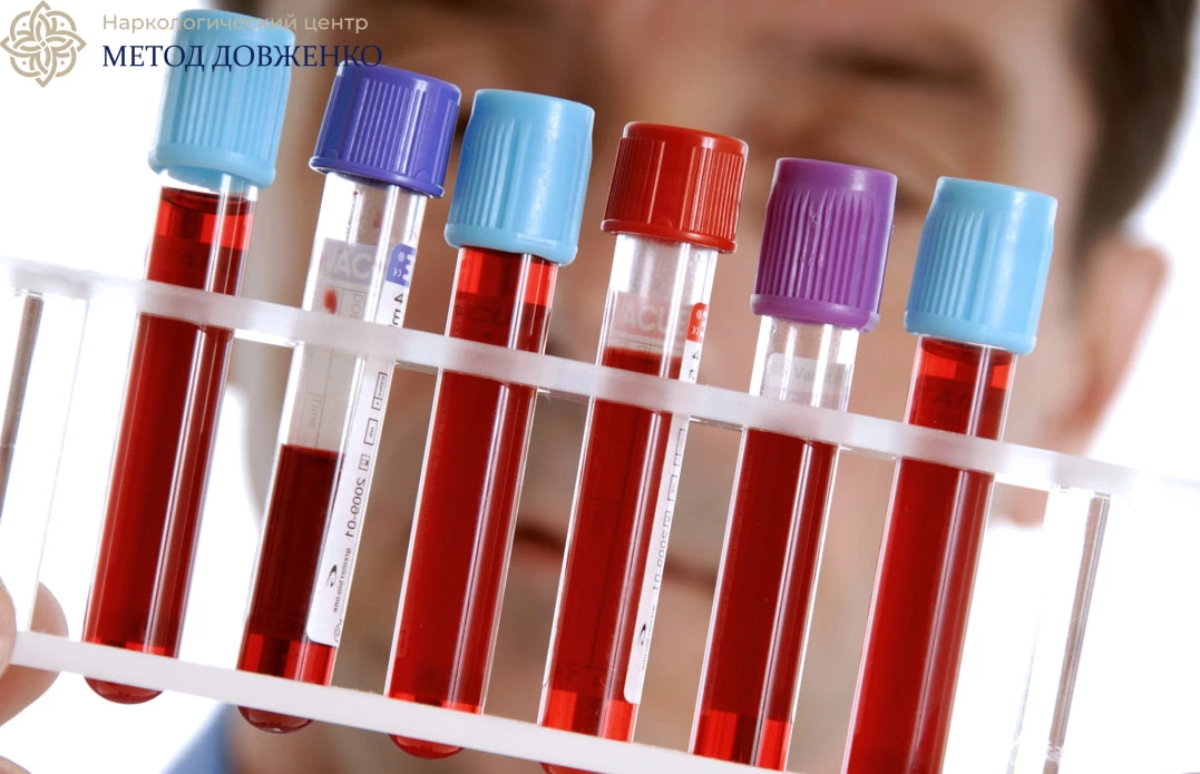 Врач проводит анализ крови Врач держит колбы с кровью