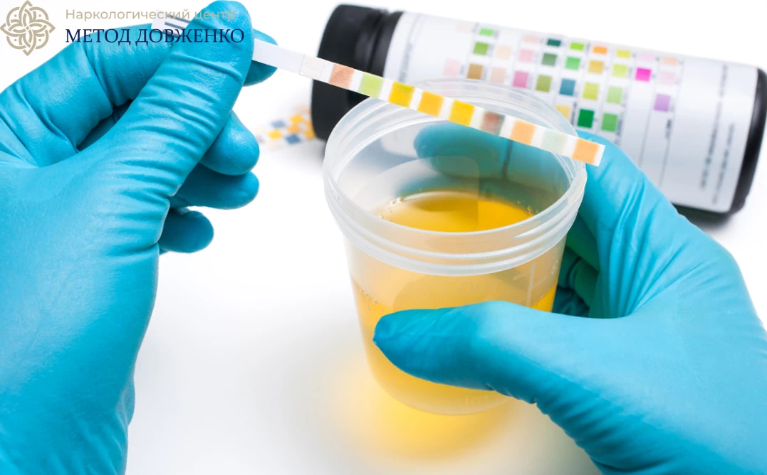 Исследование мочи Врач держит анализы и тест-полоски